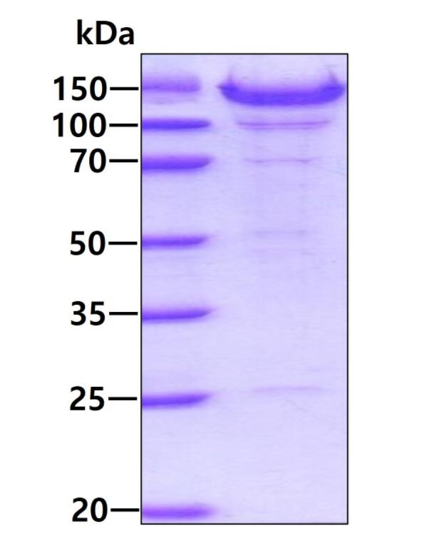 3 μg by SDS-PAGE under reducing condition and visualized by coomassie blue stain